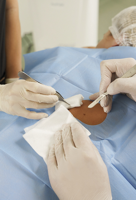 CIRUGÍA DERMATOLÓGICA